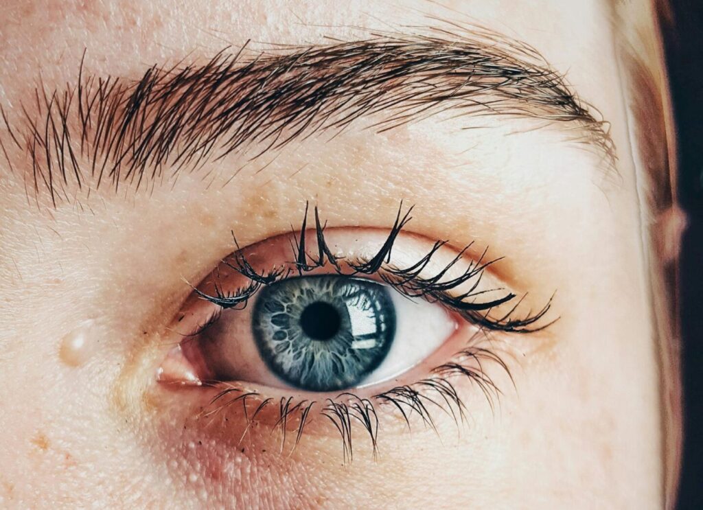 Brimonidine for clear, bright eyes is a key step in looksmaxxing.