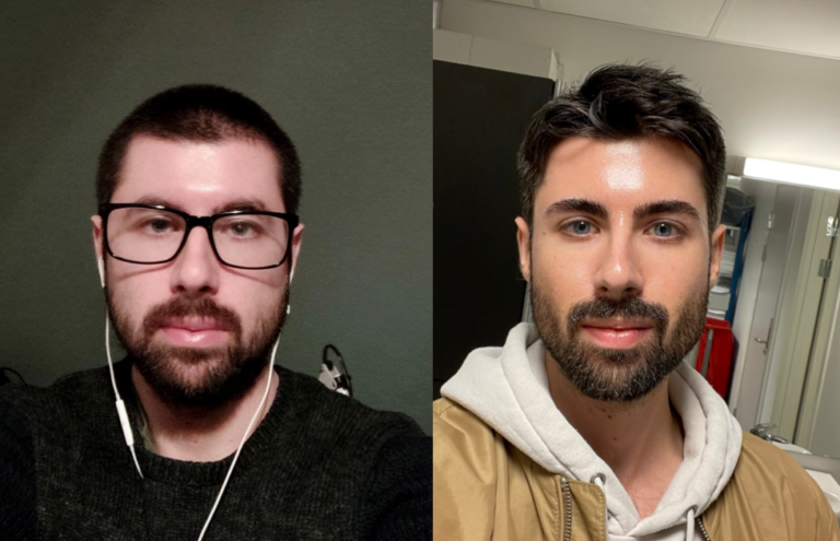 Looksmaxxing transformation