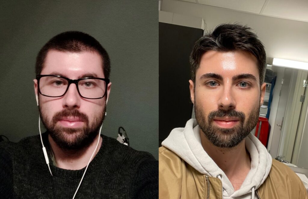 A man presents a before-and-after image showcasing his Looksmaxxing transformation between the ages of 27 and 29