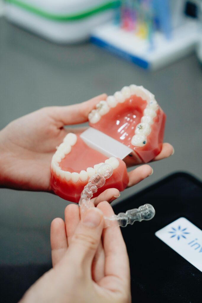 Why Clear Aligners Like Invisalign Are More Common in the US and how they are one of the Reasons Why Americans Always Have Straight and White Teeth