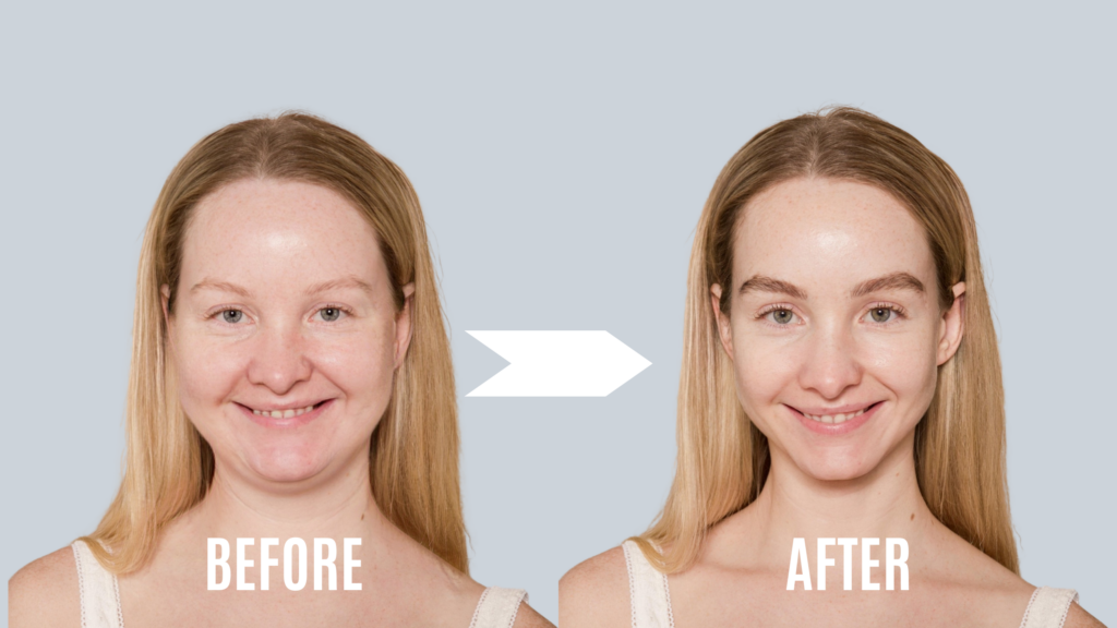 Before and after weight loss transformation, showcasing softmaxxing with glowing skin and improved confidence.